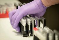 В Департаменте здравоохранения Винницкой области обнаружили подозрения на коронавирус