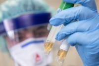 В Николаевской области зафиксировано 33 случая заболевания COVID-19, среди них беременная В Николаевской области зафиксировано 33 случая заболевания COVID-19, среди них беременная