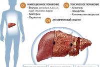 Проверьте печень: экспресс-тест на обнаружение проблем