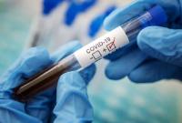В Украину прибыла новая партия вакцины Pfizer В Украину прибыла новая партия вакцины Pfizer